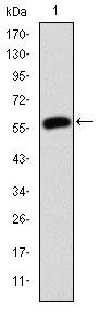 gamma Catenin Antibody in Western Blot (WB)