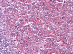 KARS Antibody in Immunohistochemistry (Paraffin) (IHC (P))