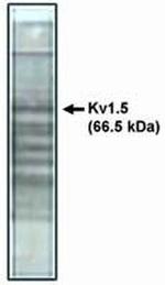 KV1.5 (KCNA5) Antibody in Western Blot (WB)