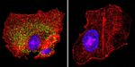 KCNQ2 Antibody in Immunocytochemistry (ICC/IF)