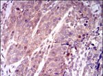 KEAP1 Antibody in Immunohistochemistry (Paraffin) (IHC (P))