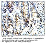 KLF6 SV1 Antibody in Immunohistochemistry (IHC)