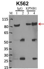 Importin beta-1 Antibody in Immunoprecipitation (IP)