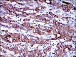 Cytokeratin 19 Antibody in Immunohistochemistry (Paraffin) (IHC (P))