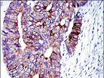 Cytokeratin 19 Antibody in Immunohistochemistry (Paraffin) (IHC (P))