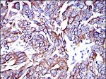 Cytokeratin 19 Antibody in Immunohistochemistry (Paraffin) (IHC (P))