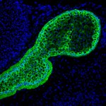 Cytokeratin 5 Antibody in Immunohistochemistry (Frozen) (IHC (F))