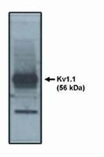 KV1.1 (KCNA1) Antibody in Western Blot (WB)