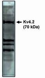 KV4.2 (KCND2) Antibody in Western Blot (WB)