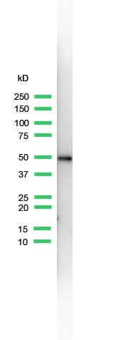 Cytokeratin 14 Antibody in Western Blot (WB)