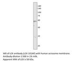 Lck Antibody in Western Blot (WB)