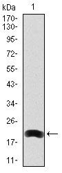 LRP5 Antibody in Western Blot (WB)