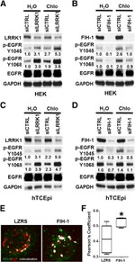 LRRK1 Antibody in Western Blot (WB)