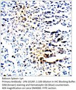 Lyn Antibody in Immunohistochemistry (IHC)