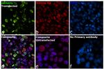 mCherry Antibody in Immunocytochemistry (ICC/IF)