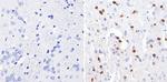 GATA3 Antibody in Immunohistochemistry (Paraffin) (IHC (P))