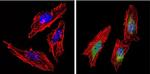 AKT2 Antibody in Immunocytochemistry (ICC/IF)