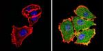 AKT2 Antibody in Immunocytochemistry (ICC/IF)