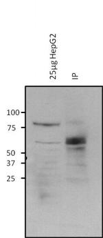 O-linked N-acetylglucosamine (O-GlcNAc) Antibody in Immunoprecipitation (IP)