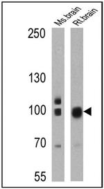 PSD-95 Antibody in Western Blot (WB)