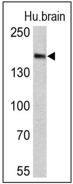 Clathrin Heavy Chain Antibody in Western Blot (WB)