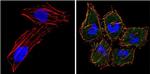 eIF4E Antibody in Immunocytochemistry (ICC/IF)