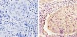 MEK1 Antibody in Immunohistochemistry (Paraffin) (IHC (P))