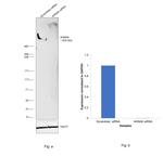 AHNAK Antibody in Western Blot (WB)