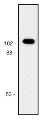 beta Galactosidase Antibody in Western Blot (WB)