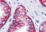 EpCAM Antibody in Immunohistochemistry (Paraffin) (IHC (P))