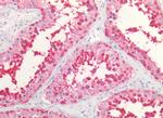 HSP90 Antibody in Immunohistochemistry (Paraffin) (IHC (P))