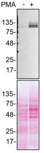 SHIP1 Antibody in Western Blot (WB)