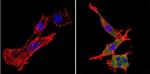 Nestin Antibody in Immunocytochemistry (ICC/IF)