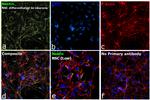 Nestin Antibody in Immunocytochemistry (ICC/IF)