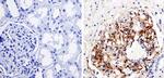 Nestin Antibody in Immunohistochemistry (IHC)