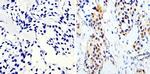 Phospho-CREB/ATF1 (Ser133, Ser63) Antibody in Immunohistochemistry (Paraffin) (IHC (P))