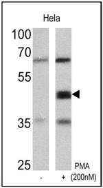 Phospho-CREB/ATF1 (Ser133, Ser63) Antibody in Western Blot (WB)