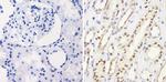 PAX8 Antibody in Immunohistochemistry (Paraffin) (IHC (P))