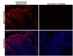 beta-3 Tubulin Antibody in Immunohistochemistry (Paraffin) (IHC (P))