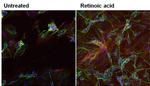 beta-3 Tubulin Antibody