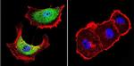 ZPR1 Antibody in Immunocytochemistry (ICC/IF)