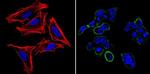 SSEA5 Antibody in Immunocytochemistry (ICC/IF)