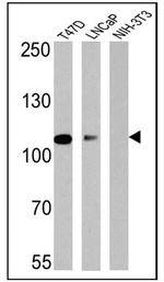 Androgen Receptor Antibody in Western Blot (WB)