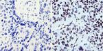 BCR-ABL Antibody in Immunohistochemistry (Paraffin) (IHC (P))