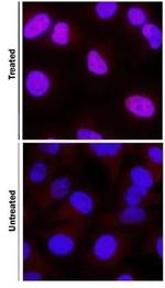 HIF1A Antibody in Immunocytochemistry (ICC/IF)