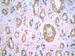 HIF1A Antibody in Immunohistochemistry (Paraffin) (IHC (P))