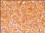 HIF1A Antibody in Immunohistochemistry (Paraffin) (IHC (P))