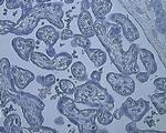 HIF1A Antibody in Immunohistochemistry (Paraffin) (IHC (P))