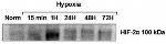 HIF-2 alpha Antibody in Western Blot (WB)