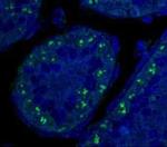 p19ARF Antibody in Immunohistochemistry (IHC)